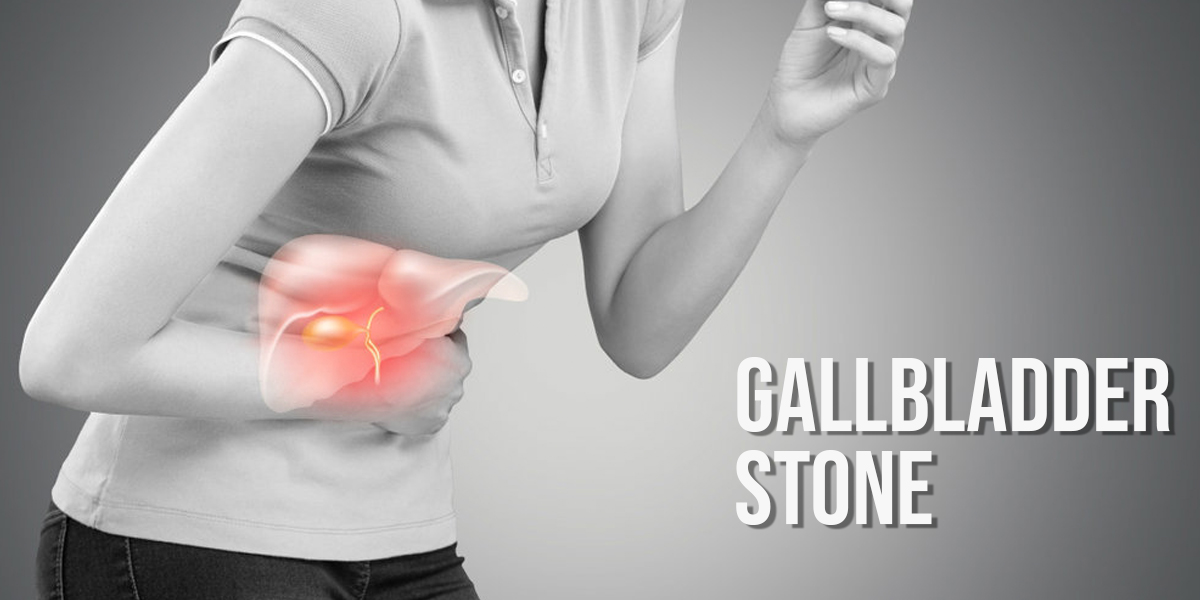 Watch Video How To Remove Gallbladder Stones in Ayurveda - Without Surgery