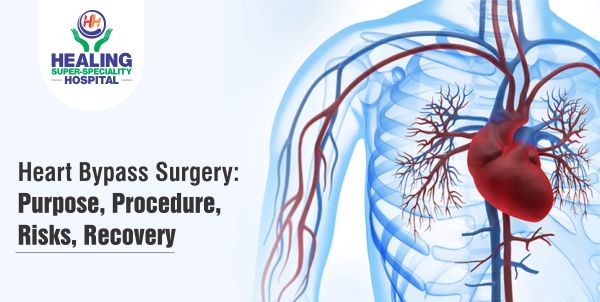 Heart Bypass Surgery: Purpose, Procedure, Risks, Recovery